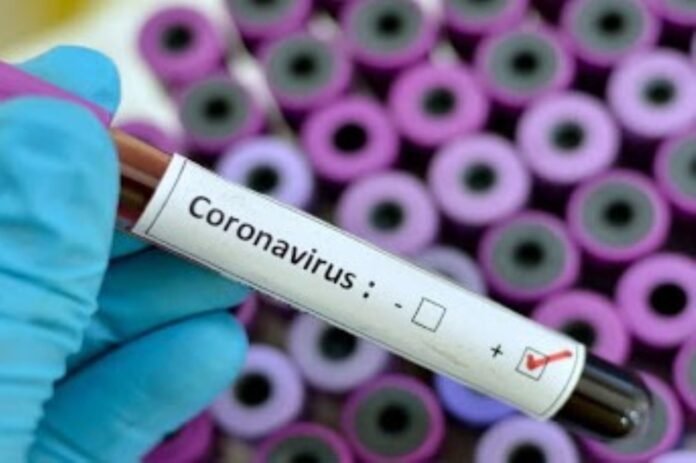 Coronavirus en Perú / Foto: Andina